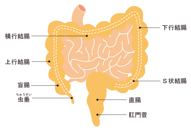 S 状 結腸 癌