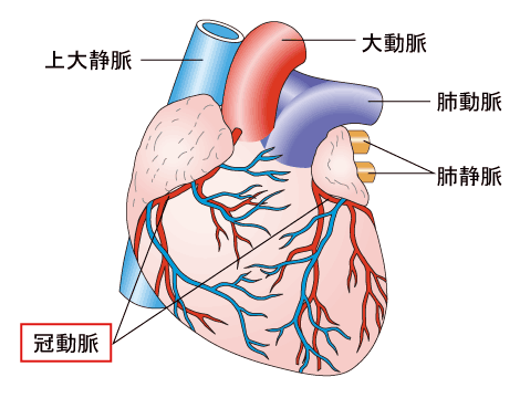 虚血性心疾患 | 生活習慣病 | 生活習慣病を予防する 特定非営利活動 ...