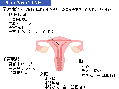 出血 不正出血 気になるからだの危険信号 生活習慣病を予防する 特定非営利活動法人 日本成人病予防協会