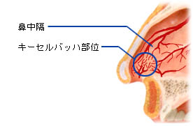 原因 鼻血 出る