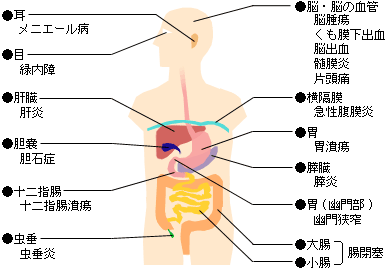 吐き気 気になるからだの危険信号 生活習慣病を予防する 特定非営利活動法人 日本成人病予防協会