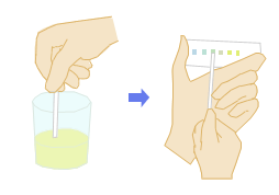 出血　～血尿～　－気になるからだの危険信号－