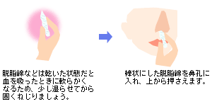 出血 鼻血 気になるからだの危険信号 生活習慣病を予防する 特定非営利活動法人 日本成人病予防協会