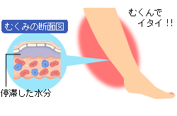 が 取れる 食べ物 むくみ