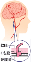 左 後ろ 頭 が 痛い