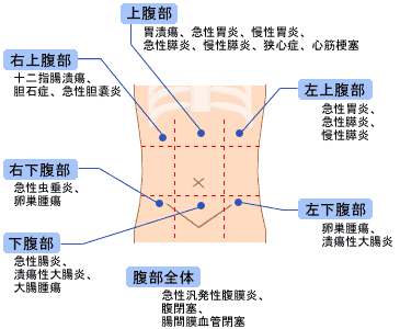 腹痛 気になるからだの危険信号 痛み 生活習慣病を予防する 特定非営利活動法人 日本成人病予防協会