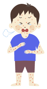 麻疹