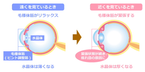 ピント調整を担う筋肉の疲れ