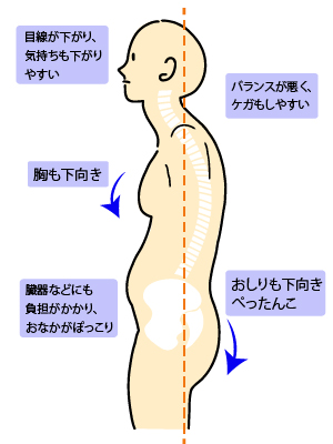 悪い姿勢